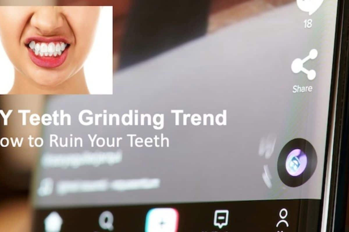 dental trends