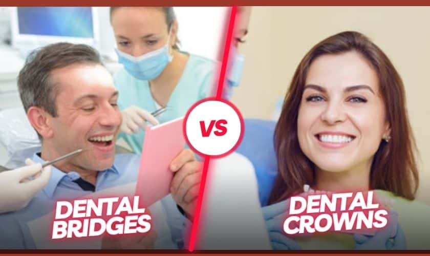 Are Dental Bridges And Dental Crowns Long-Lasting?