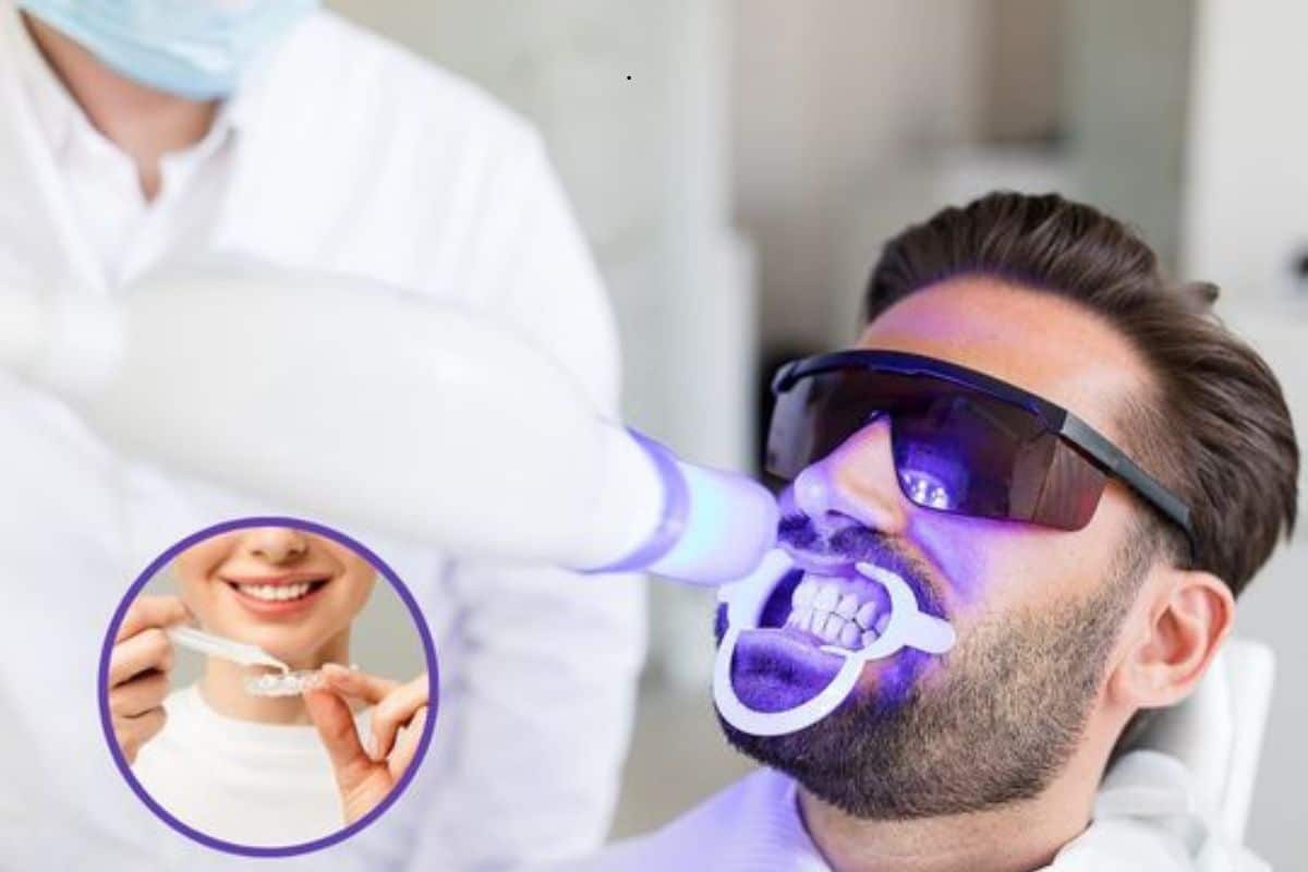 Teeth whitening Chandler