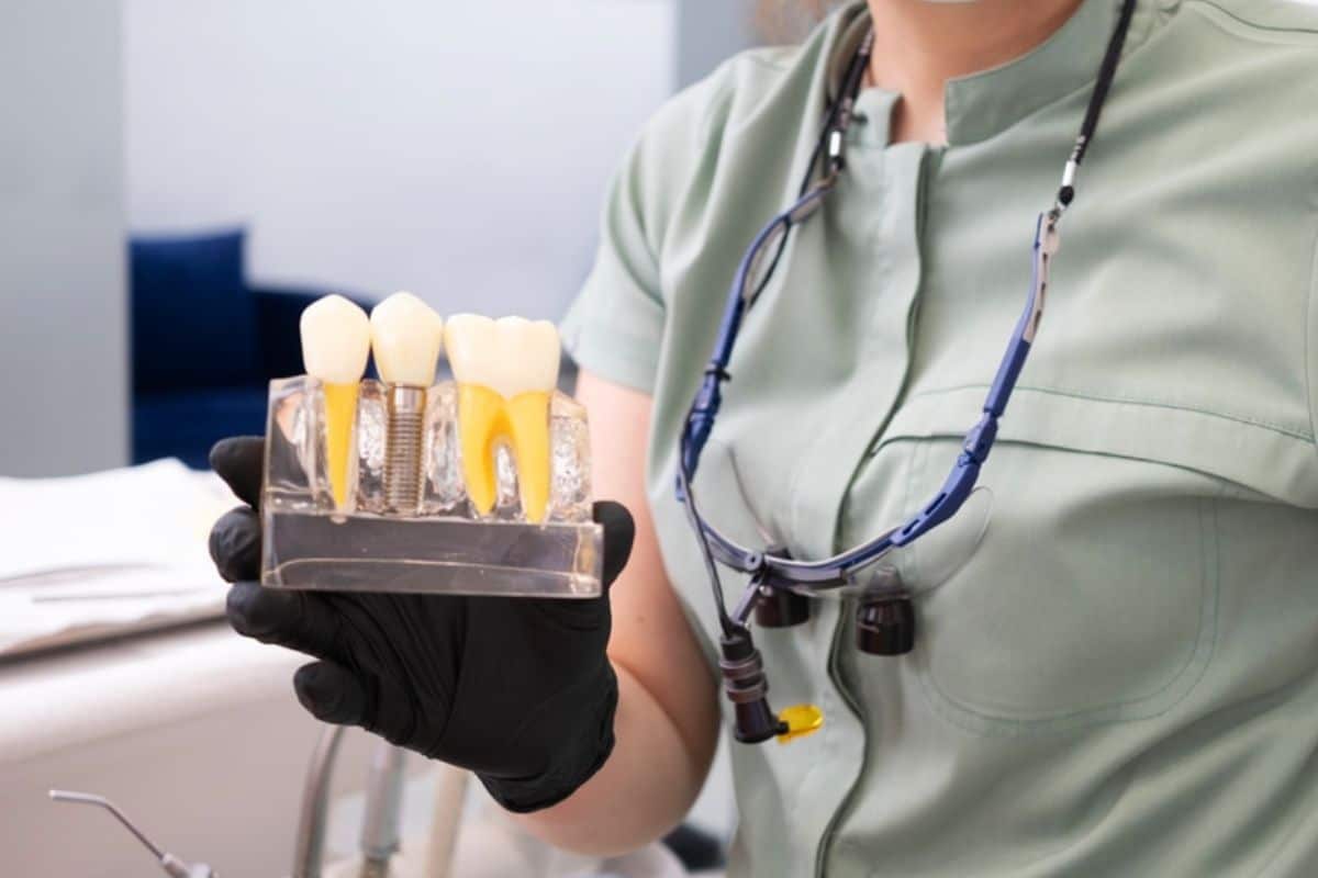 maintaining your dental Implants