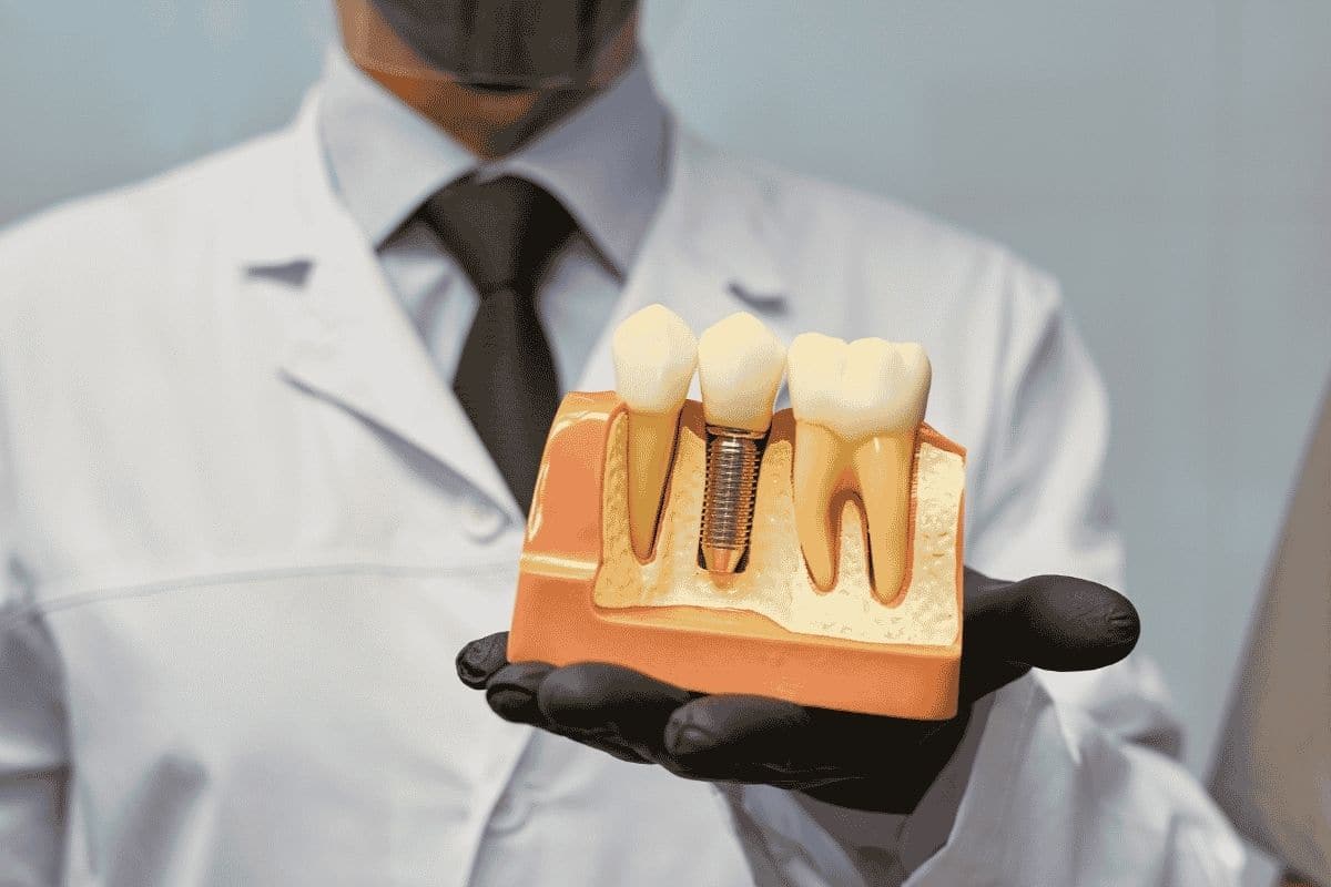 Dental Implants